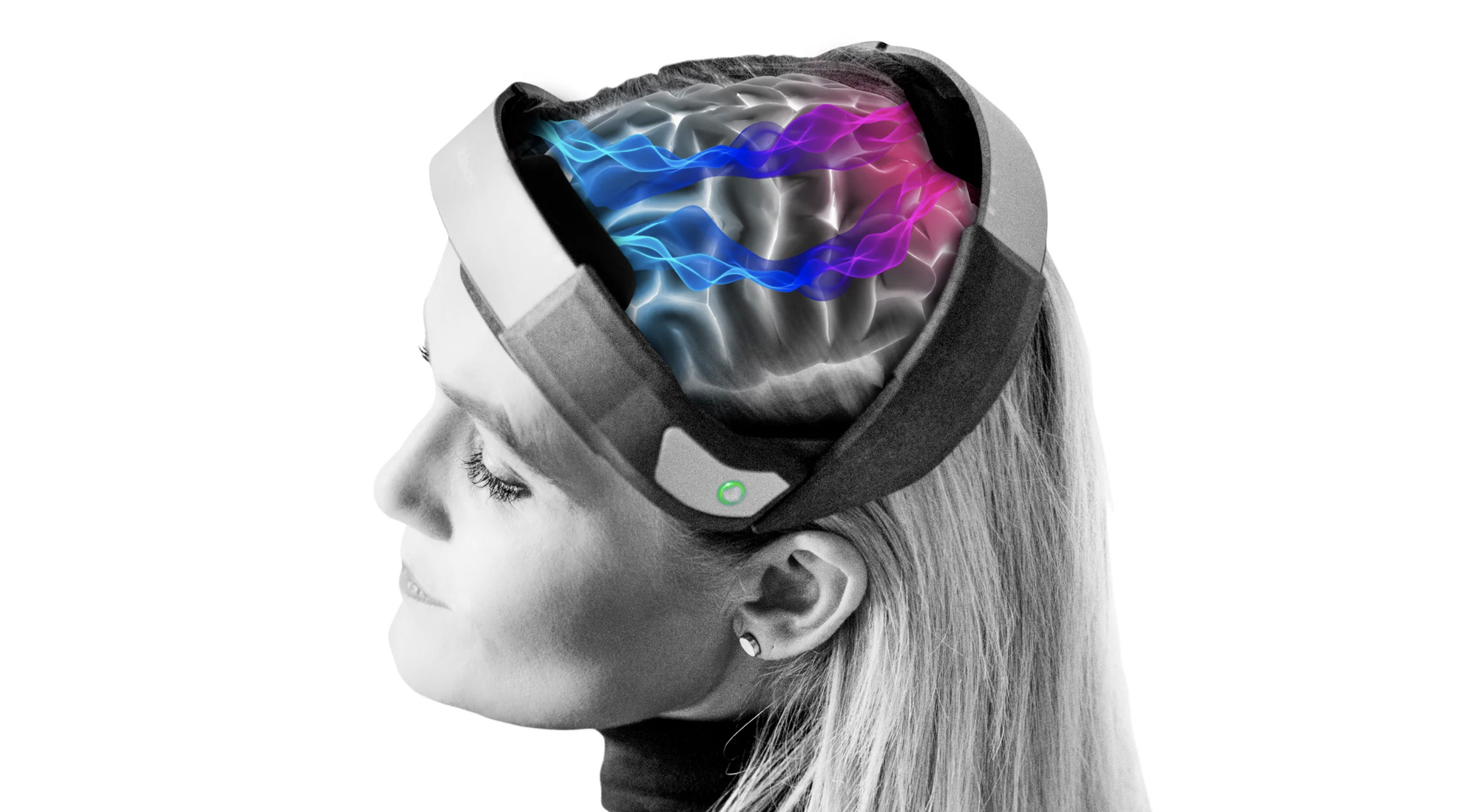 Estimulaci&oacute;n Transcraneal por Corriente Directa
