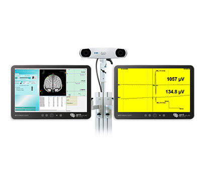Estimulación Magnética Transcraneal Guiada por Neuroimagen Funcional